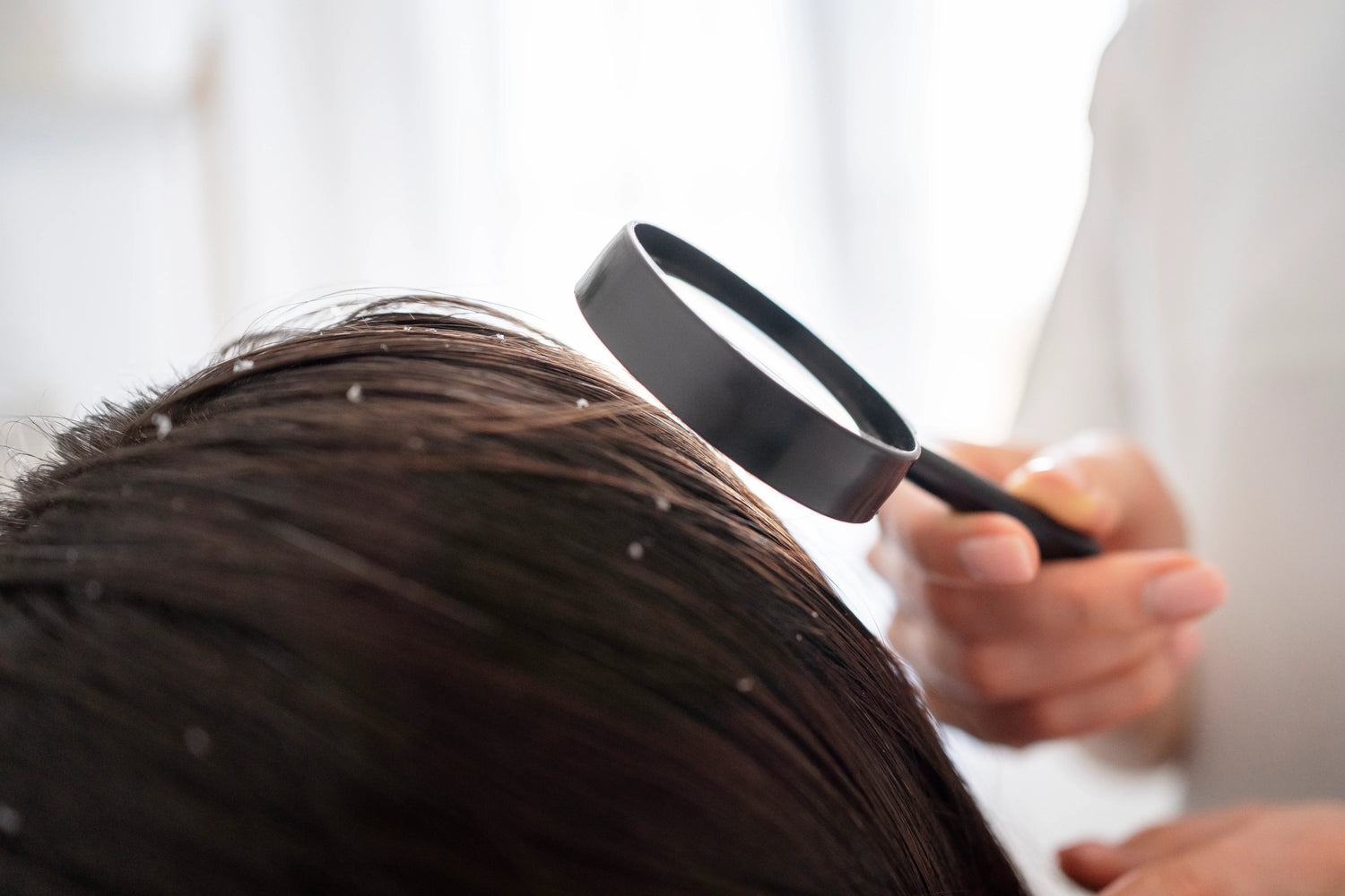 Dandruff vs Dry Scalp: How to Tell the Difference and Fix Both (Pakistan Guide 2026)